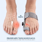 The joint pushed out, and the same foot with the BunionCore splint holding the toe in line